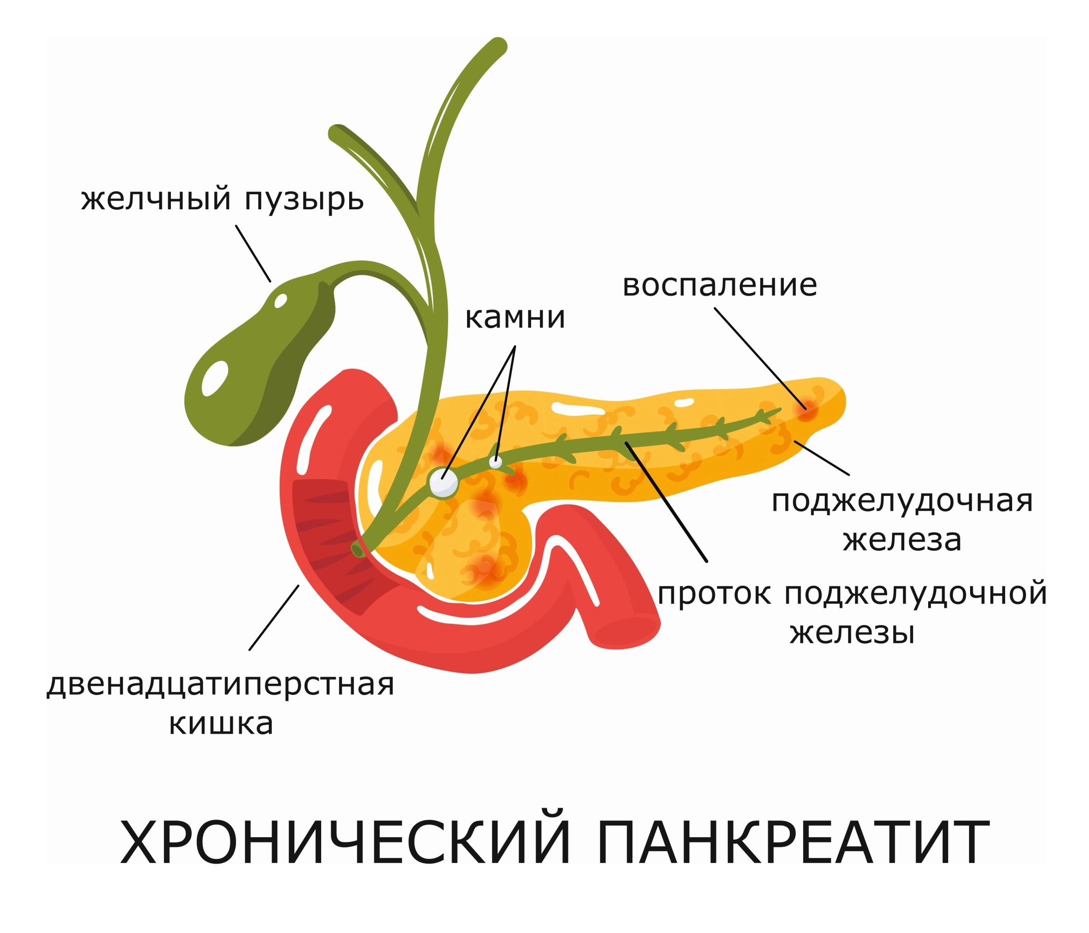 панкреатит стул со слизью