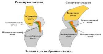 Не сгибается колено. Внутрисуставные связки коленного сустава. Коленный сустав сгибается. Пучки передней крестообразной связки.