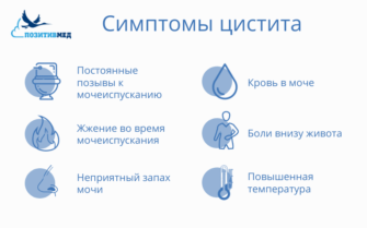 Что нельзя делать при цистите у женщин. Симптомы цистицистита. Цистит симптомы. Цистит у женщин симптомы. Причины цистита у женщин.